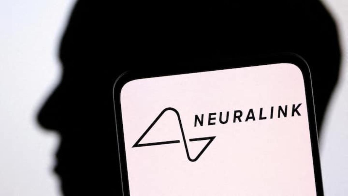 Elon Musk: Neuralink işitme kaybını düzeltebilir